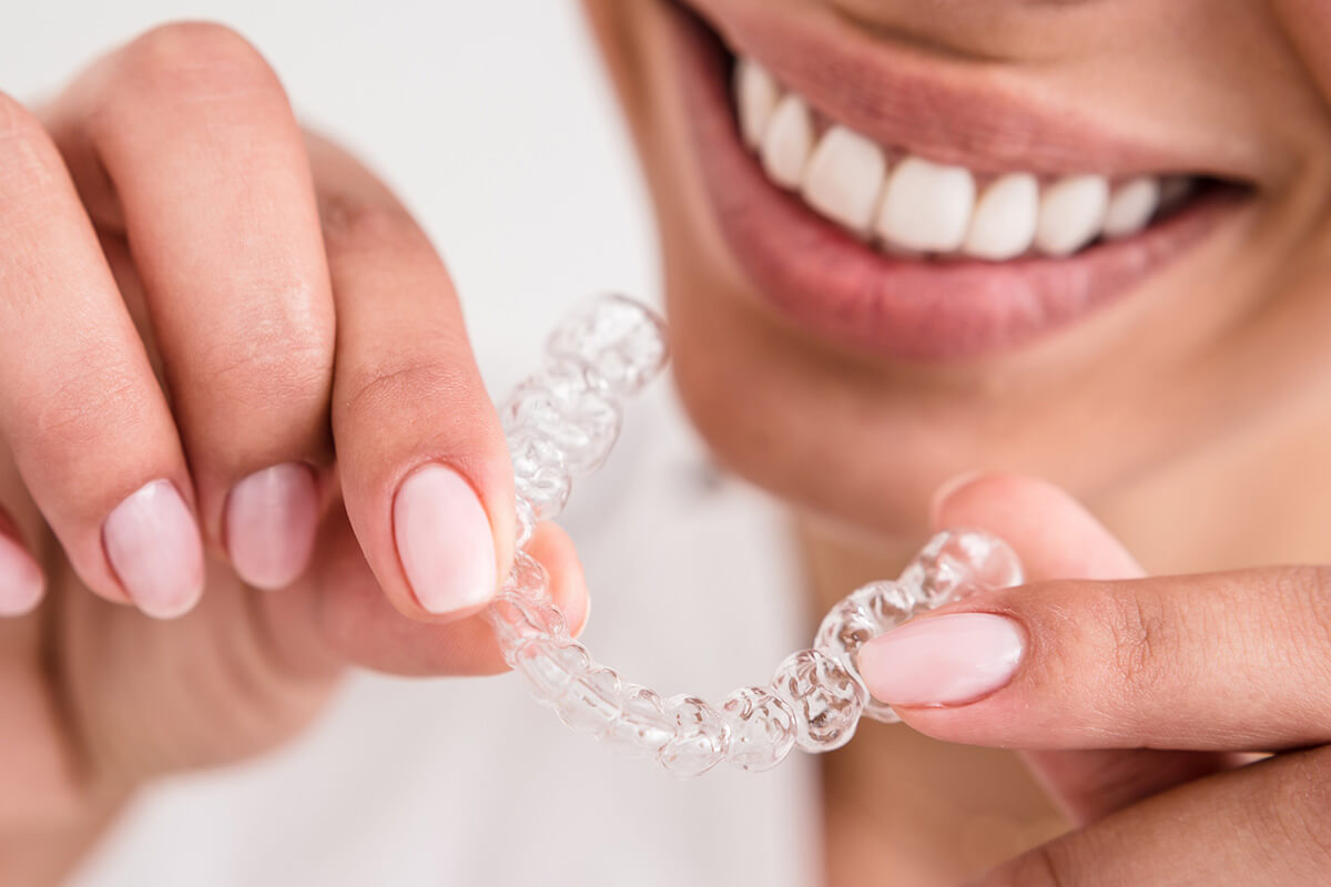 Does Insurance Cover Invisalign? Bella Dental