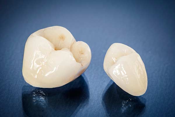 Porcelain Dental Crowns
