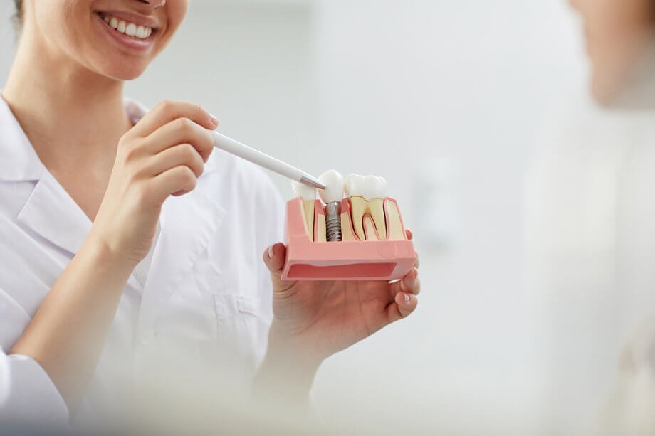 dental professional uses a model to demonstrate a dental implant