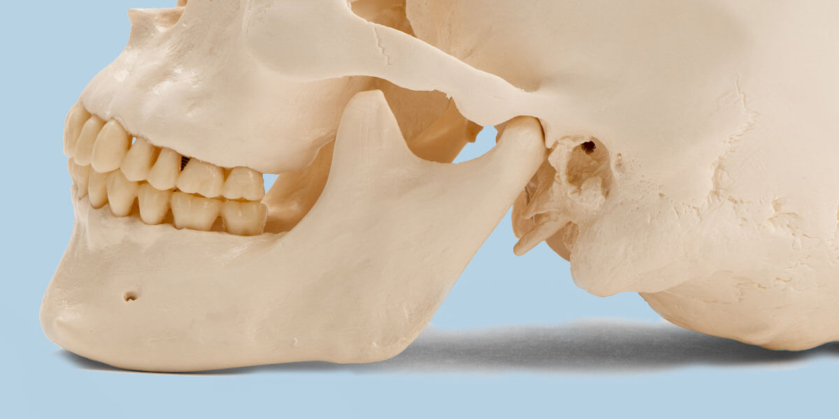 Side View Model of Skull Showing TMJ Disorder